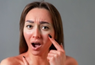 كيف تعالجين حروق الشمس بطرق فعّالة؟