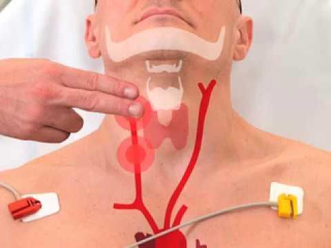 طبيب يحذر من ممارسة خاطئة لدى بعض الرقاة قد تؤدي إلى الوفاة