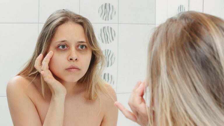الهالات السوداء تحت العين تدل على مشاكل صحية أخرى