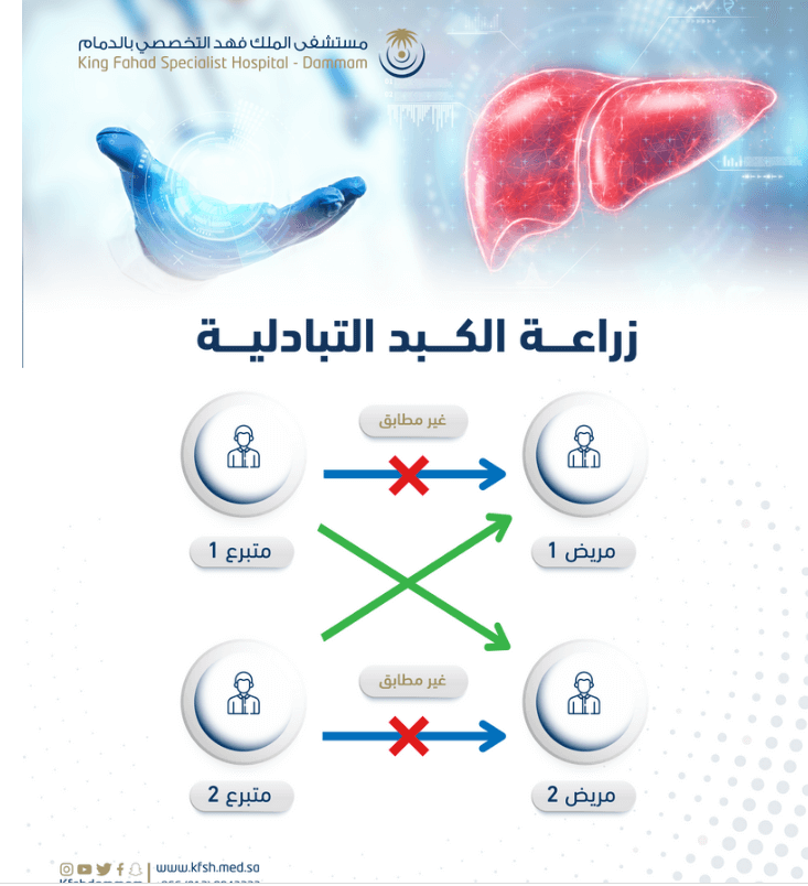 قصة أب وابنه وطفل.. نجاح أول زراعة كبد تبادلية في الشرق الأوسط بالدمام