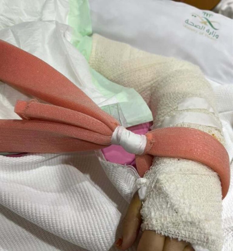 معنفة جدة تخضع لعملية استمرت 9 ساعات.. وهذا ما طلبته من الجميع