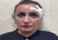 ضبط أم روسية باعت رضيعها لإجراء عملية تجميل في أنفها