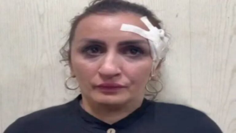 ضبط أم روسية باعت رضيعها لإجراء عملية تجميل في أنفها