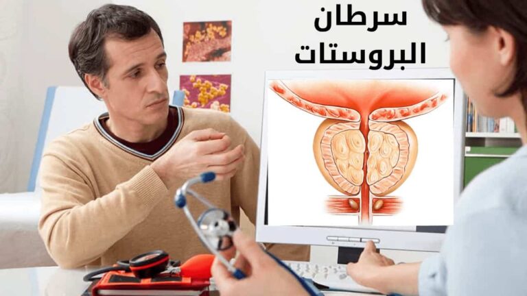 الكشف عن 10 أعراض تحذيرية تشير إلى الإصابة بسرطان البروستات