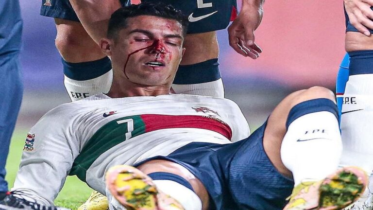 شاهد.. رونالدو يتعرض لإصابة قوية بأنفه في مواجهة التشيك