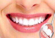 حيل صحية شائعة تضر بأسناننا رغم فوائدها للجسم