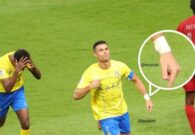 كشف سر الربطة البيضاء في معصم رونالدو أثناء مباراة الدحيل القطري