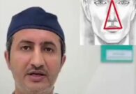 شاهد.. طبيب يحذر من العبث بمنطقة مثلث الخطر بالوجه