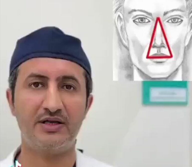 شاهد.. طبيب يحذر من العبث بمنطقة مثلث الخطر بالوجه