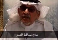 دكتور جابر القحطاني يكشف عن علاج منزلي لتساقط الشعر -فيديو
