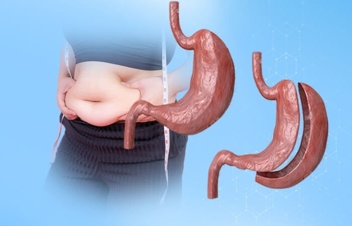فيديو.. استشاري جراحة مخ وأعصاب يحذر من مخاطر عمليات التكميم على الدماغ