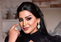 شاهد ريم عبدالله تواجه انتقادات بسبب تغير ملامحها بعد عمليات التجميل